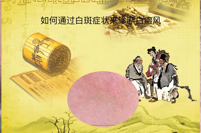 https://www.bdfsjzyy.com/d/file/p/85b4da6c1690533e2f8ee956f132c72e.jpeg