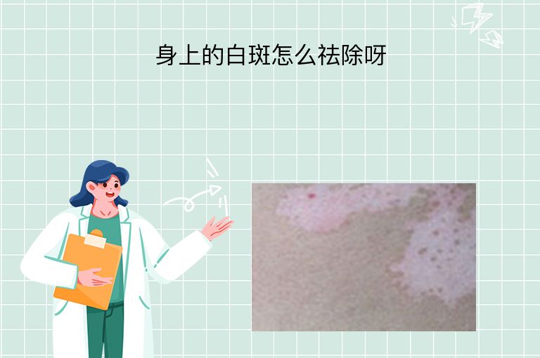 身上的白斑怎么祛除呀”