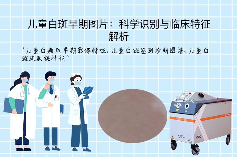 儿童白斑早期图片：科学识别与临床特征解析