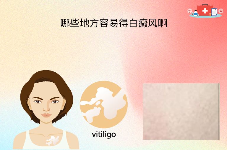 https://www.bdfsjzyy.com/d/file/p/7b0c9f567c59d0ec9d374c6280cc931a.jpeg