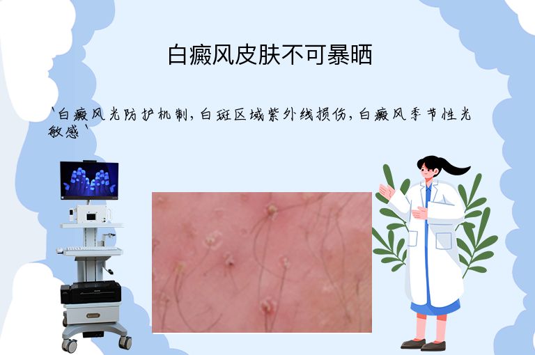 白癜风皮肤不可暴晒