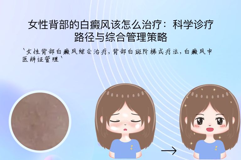 女性背部的白癜风该怎么治疗：科学诊疗路径与综合管理策略