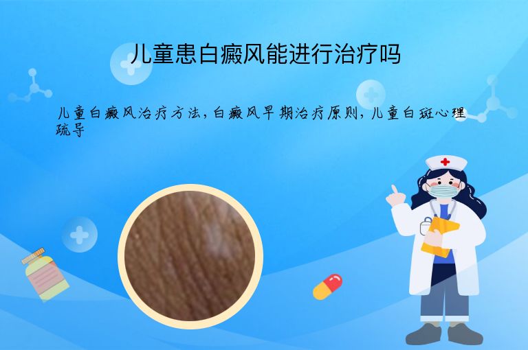 儿童患白癜风能进行治疗吗”