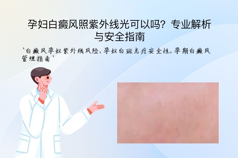 孕妇白癜风照紫外线光可以吗?专业解析与安全指南”