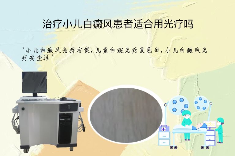 治疗小儿白癜风患者适合用光疗吗