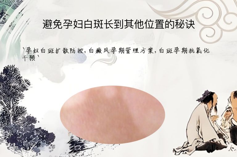 避免孕妇白斑长到其他位置的秘诀