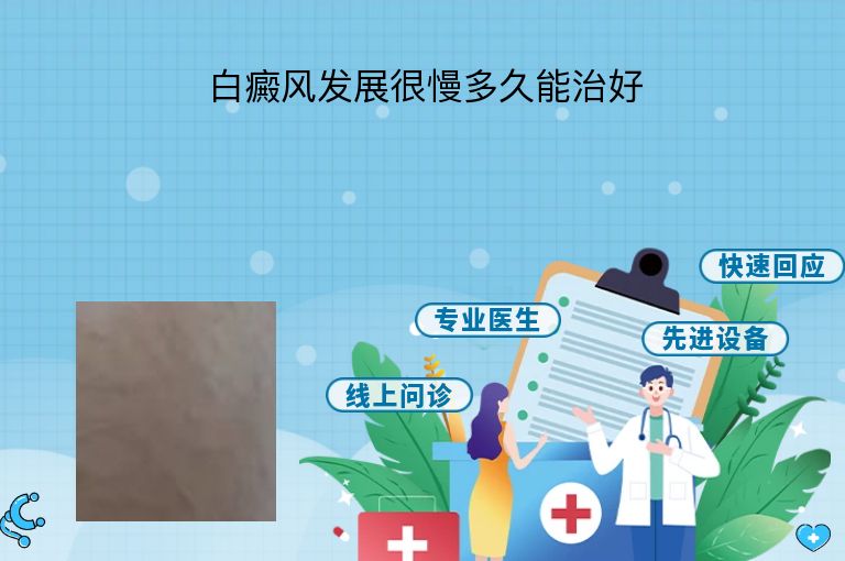 白癜风发展很慢多久能治好”