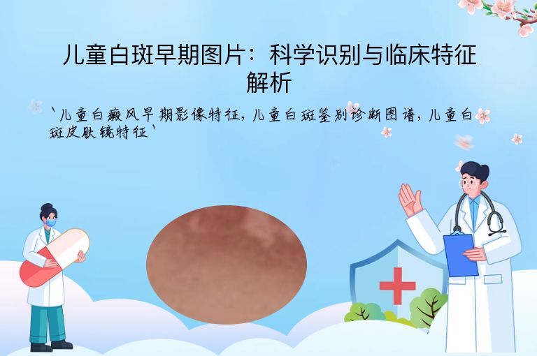 儿童白斑早期图片：科学识别与临床特征解析