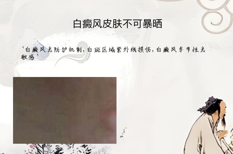 白癜风皮肤不可暴晒