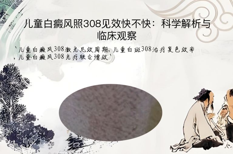 儿童白癜风照308见效快不快：科学解析与临床观察