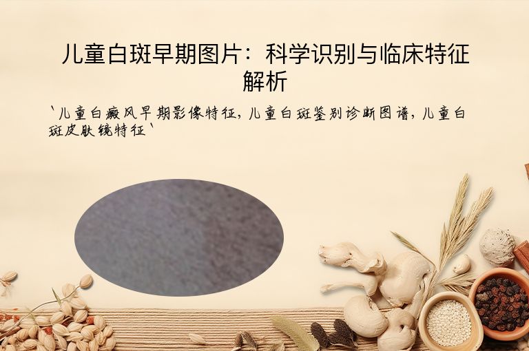 儿童白斑早期图片:科学识别与临床特征解析