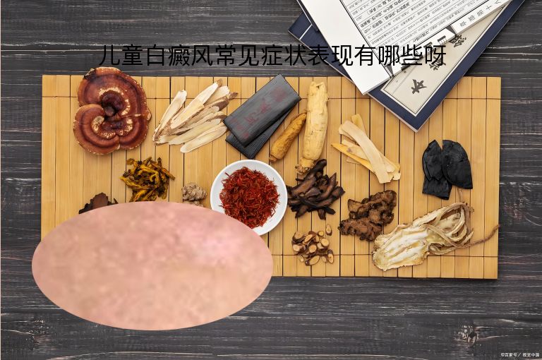 https://www.bdfsjzyy.com/d/file/p/7eee240f29af41e4f5b95b4e50c7367f.jpeg