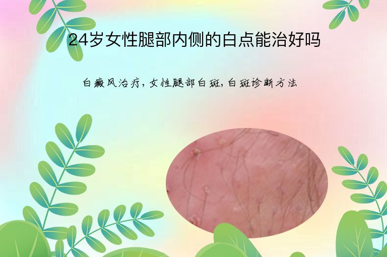 24岁女性腿部内侧的白点能治好吗”