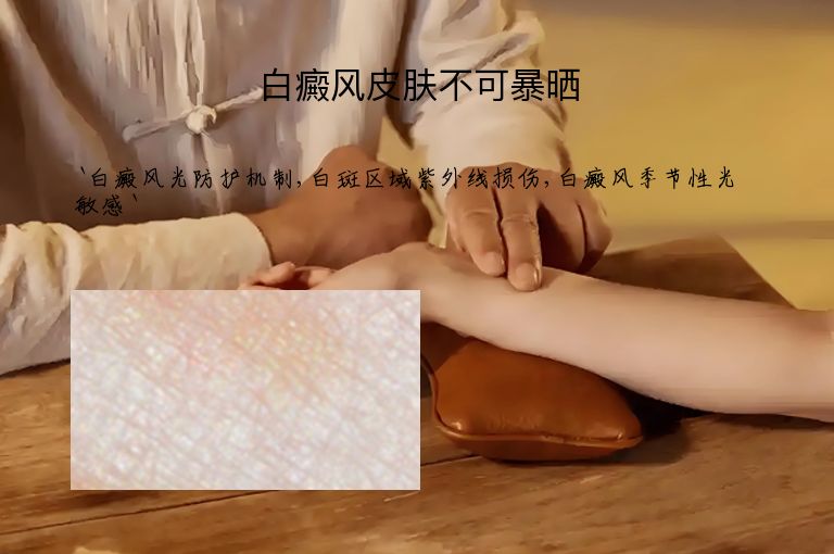 白癜风皮肤不可暴晒