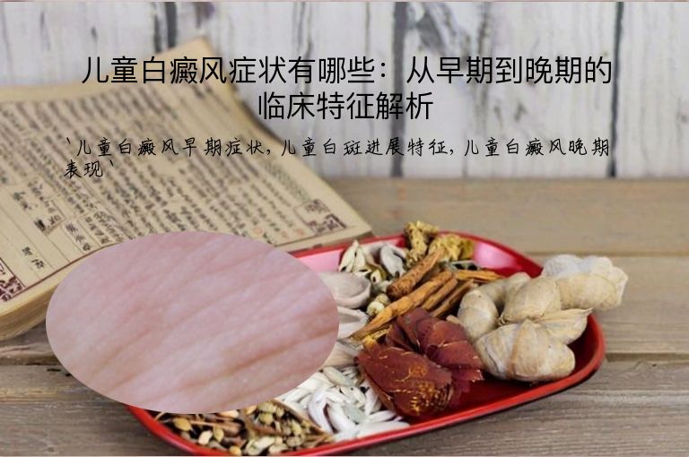 儿童白癜风症状有哪些：从早期到晚期的临床特征解析