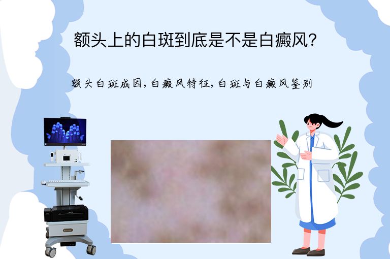 https://www.bdfsjzyy.com/d/file/p/cb07b8f7ea7fe8fe3f84fc35981a7440.jpeg