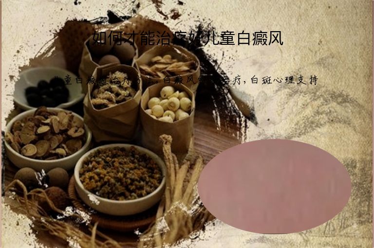 如何才能治疗好儿童白癜风”