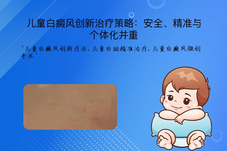 儿童白癜风创新治疗策略：安全、精准与个体化并重
