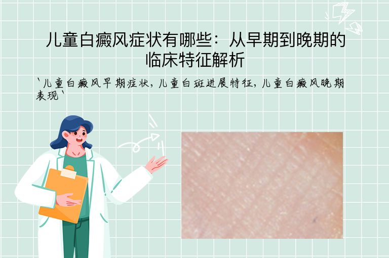 儿童白癜风症状有哪些:从早期到晚期的临床特征解析