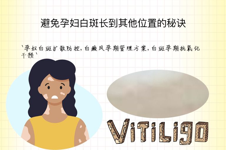 避免孕妇白斑长到其他位置的秘诀