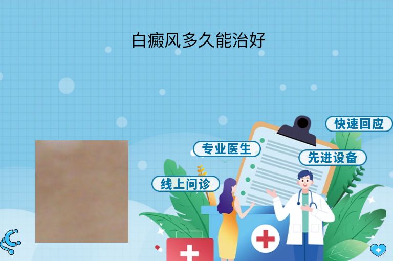 白癜风多久能治好”