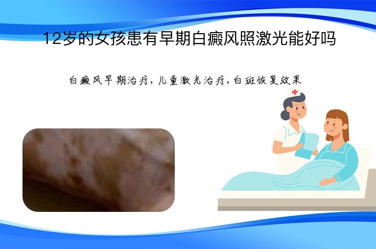 12岁的女孩患有早期白癜风照激光能好吗”