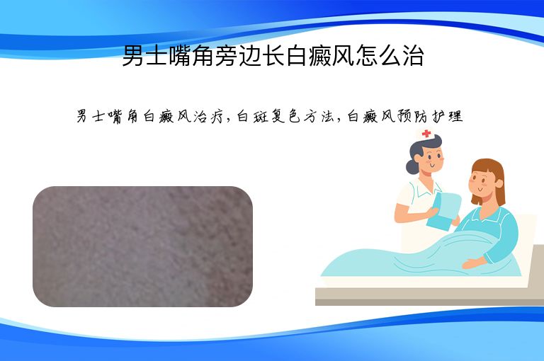 男士嘴角旁边长白癜风怎么治”