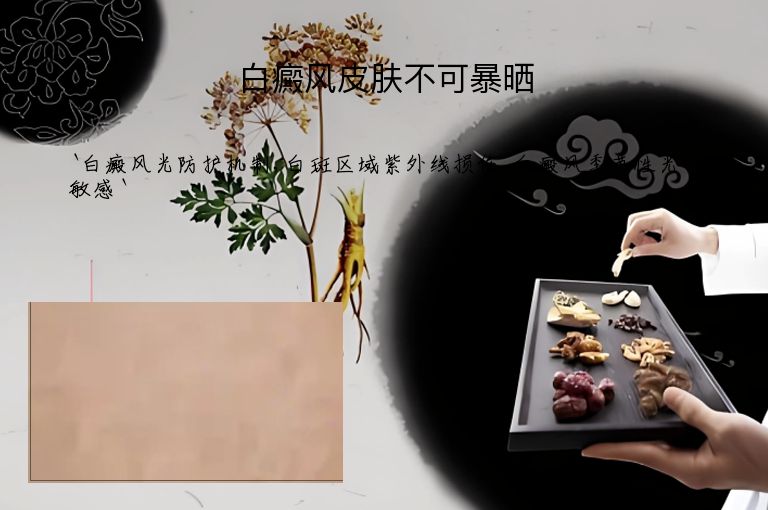 白癜风皮肤不可暴晒