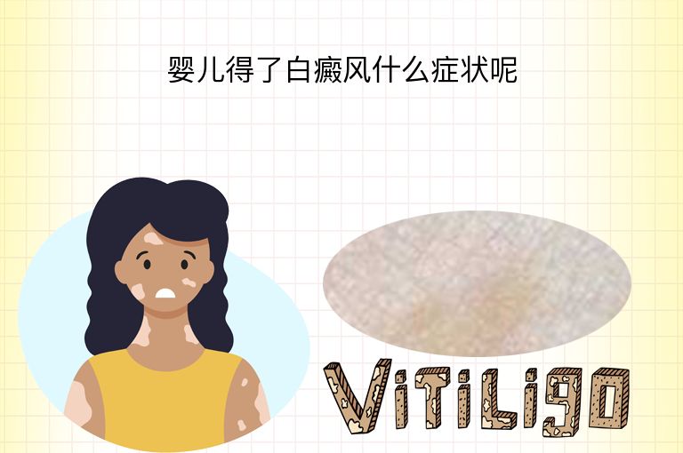 https://www.bdfsjzyy.com/d/file/p/a65c29f02a6ab1fdf8c0652c075a45d8.jpeg