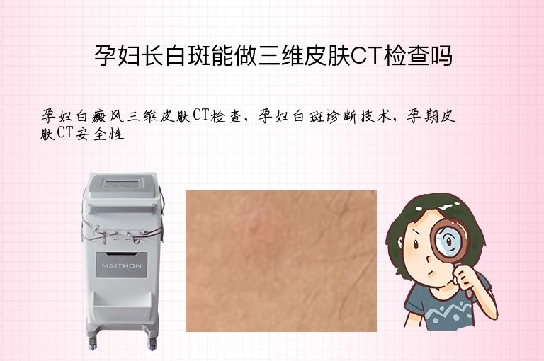 孕妇长白斑能做三维皮肤CT检查吗”