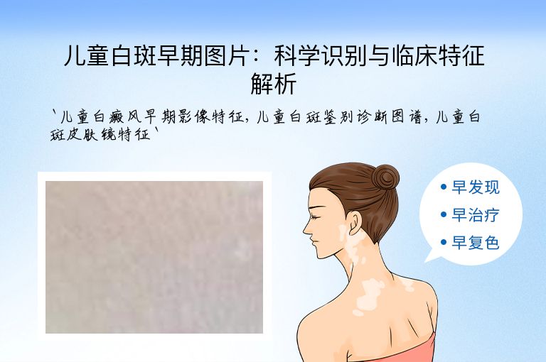 儿童白斑早期图片：科学识别与临床特征解析