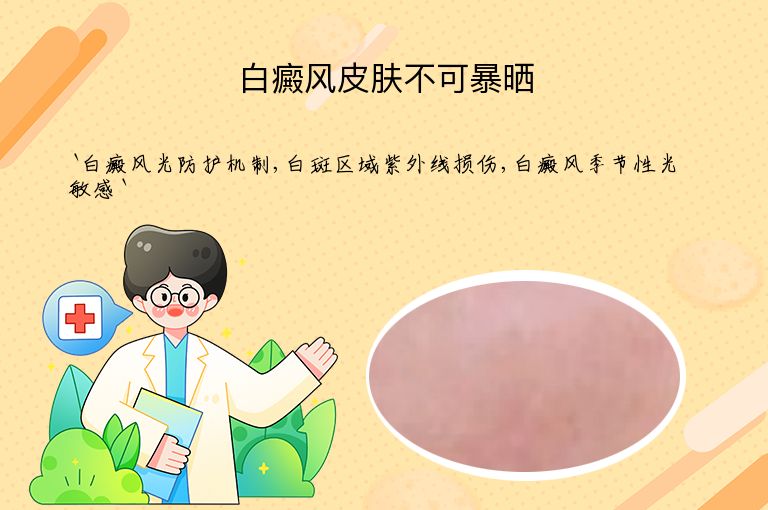 白癜风皮肤不可暴晒