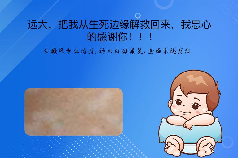 https://www.bdfsjzyy.com/d/file/p/d3a966232348ce6906c4529d8eb96ff5.jpeg
