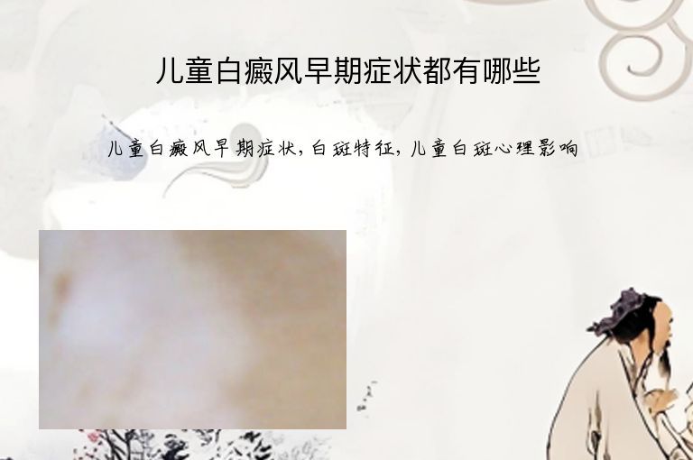 https://www.bdfsjzyy.com/d/file/p/c21decc598cda751e4141e7733492a7b.jpeg