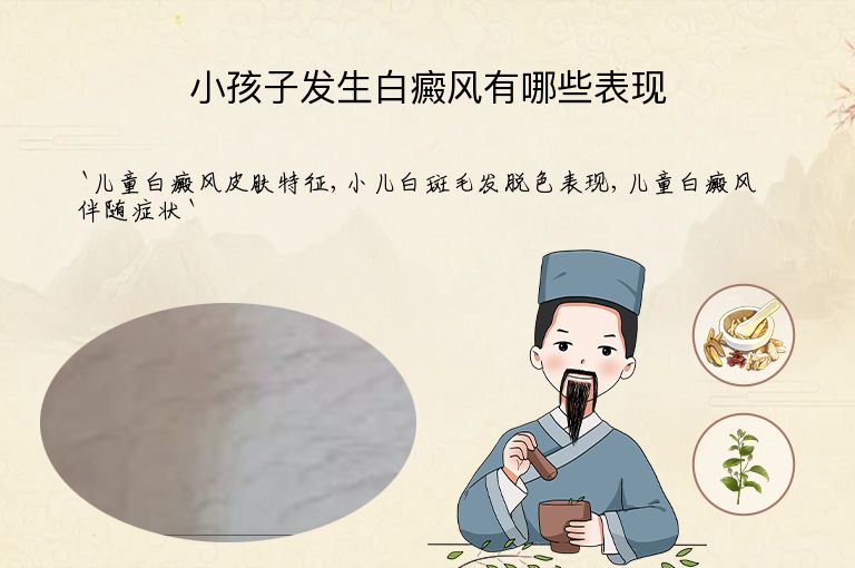 小孩子发生白癜风有哪些表现”