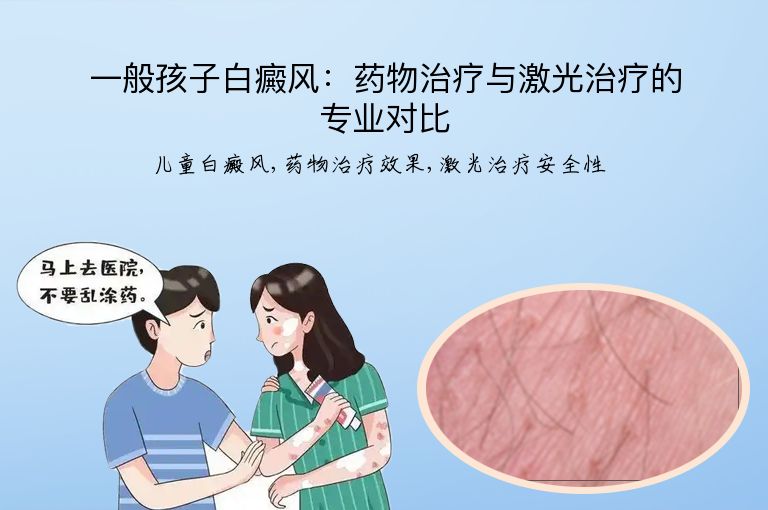 一般孩子白癜风：药物治疗与激光治疗的专业对比”