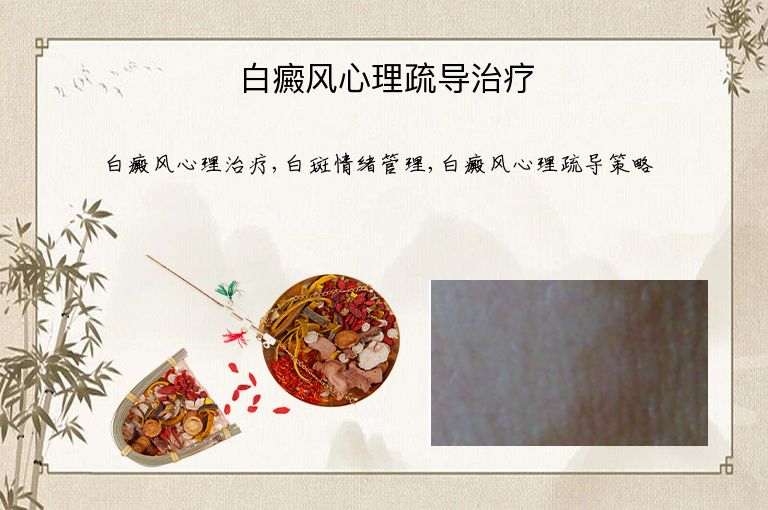 白癜风心理疏导治疗”