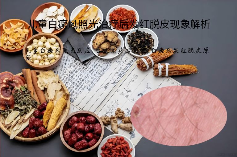 https://www.bdfsjzyy.com/d/file/p/ff6a0966cc2c6612caa73ffa05d64d62.jpeg
