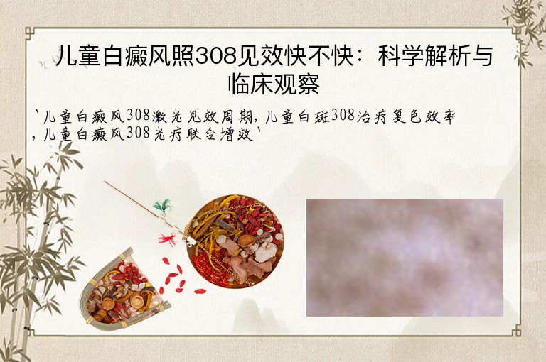 儿童白癜风照308见效快不快：科学解析与临床观察
