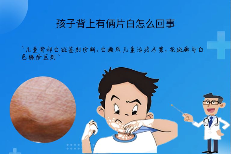 孩子背上有俩片白怎么回事