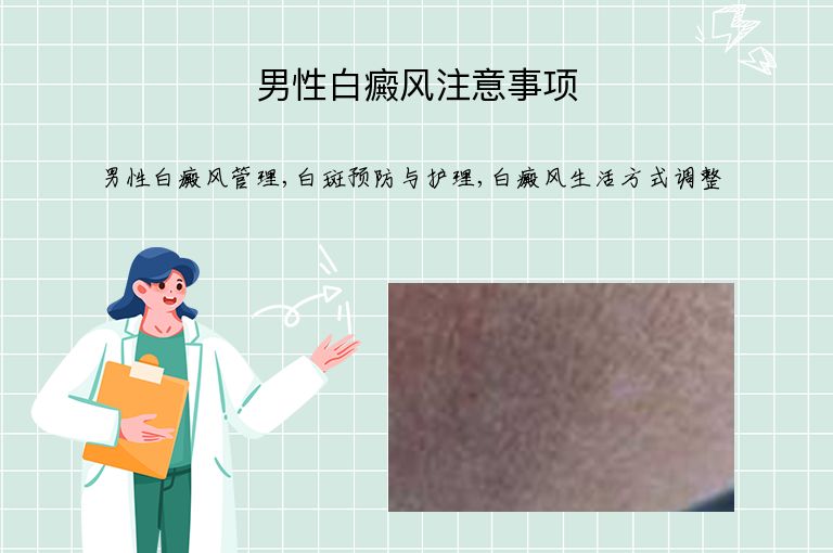 男性白癜风注意事项”
