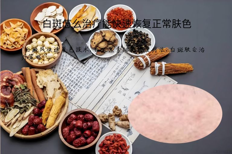 白斑怎么治疗能快速恢复正常肤色”