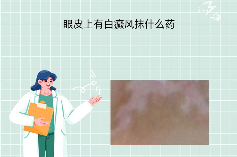 眼皮上有白癜风抹什么药”