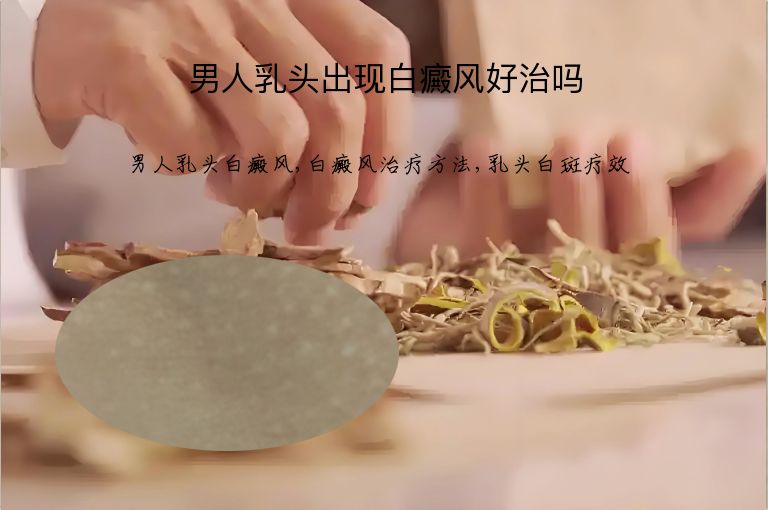 男人乳头出现白癜风好治吗”