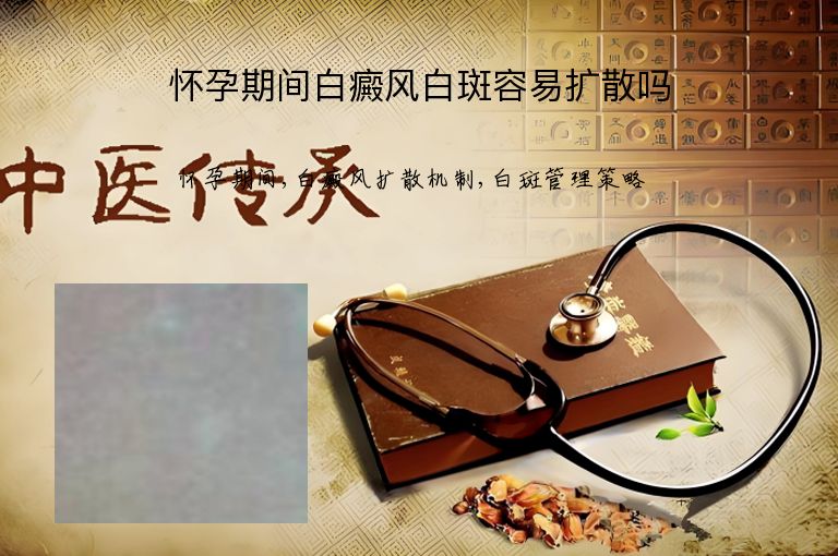 怀孕期间白癜风白斑容易扩散吗”