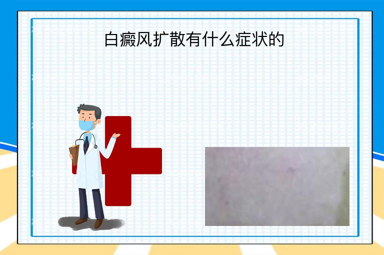 https://www.bdfsjzyy.com/d/file/p/06ca460d86265f54291abacf6ef11eea.jpeg