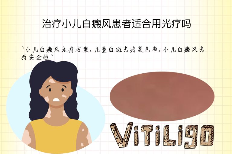 治疗小儿白癜风患者适合用光疗吗