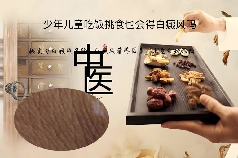少年儿童吃饭挑食也会得白癜风吗”