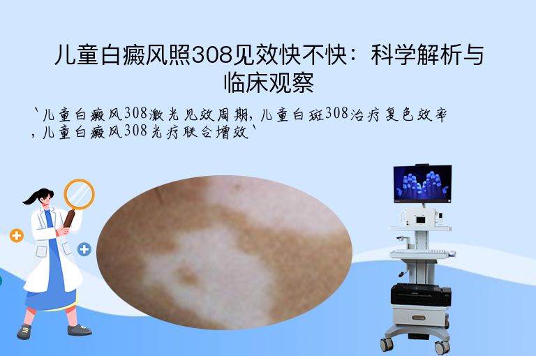 儿童白癜风照308见效快不快:科学解析与临床观察