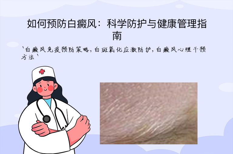 如何预防白癜风：科学防护与健康管理指南